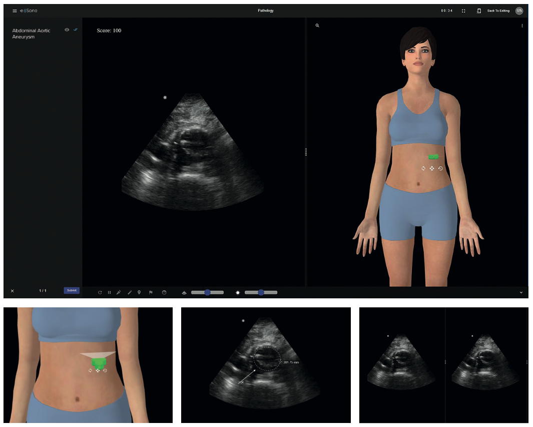 e Sono ultrasound simulator provided by Echo Healthcare